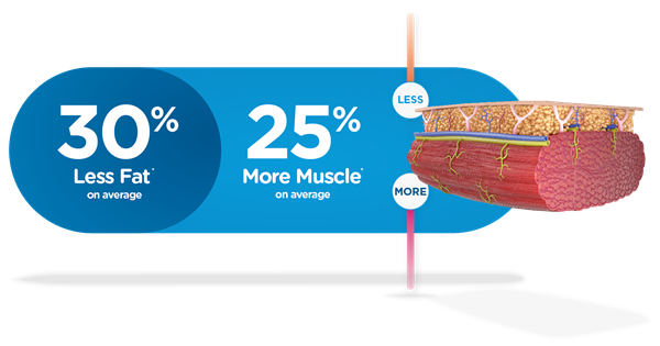 30% less fat and 25% more muscle Emsculpt NEO