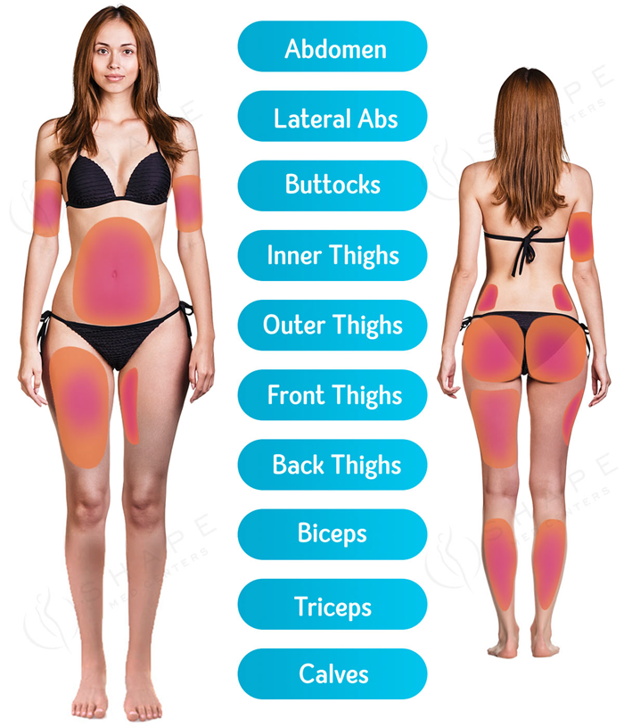 Emsculpt Treatment Areas