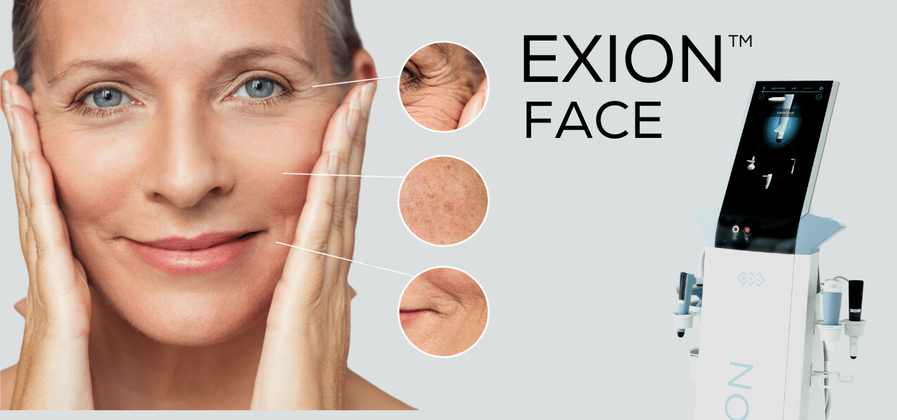 EXION Face at Shape Med Centers