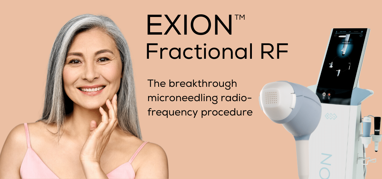 EXION Fractional RF at Shape Med Centers