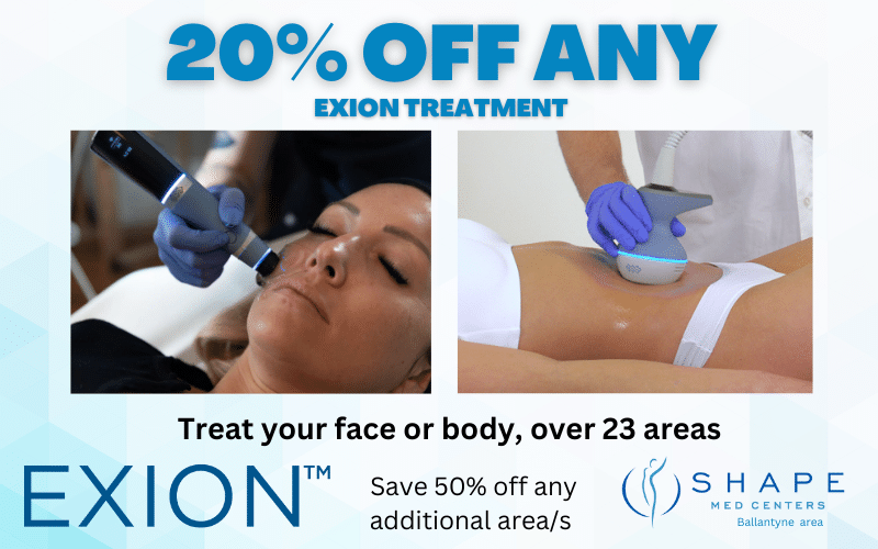 20% off EXION at Shape Med Centers in Charlotte