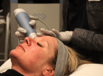 EXION RF Microneedling at Shape Med Centers