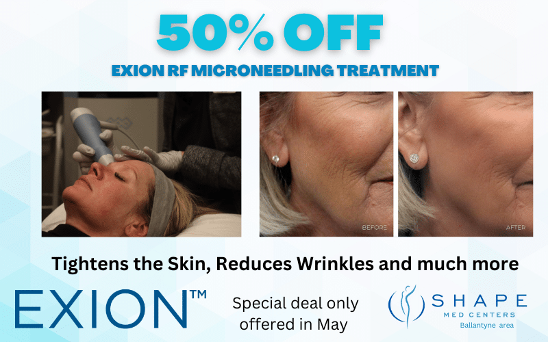 50% off Microneedling at Shape Med Centers