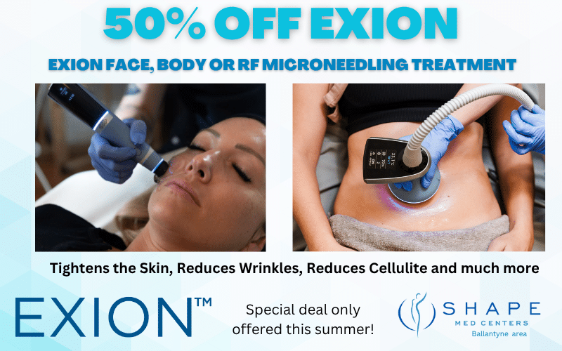 50% off EXION at Shape Med Centers